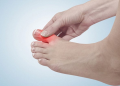Bệnh đau khớp ngón là gì? Nguyên nhân và cách phòng ngừa